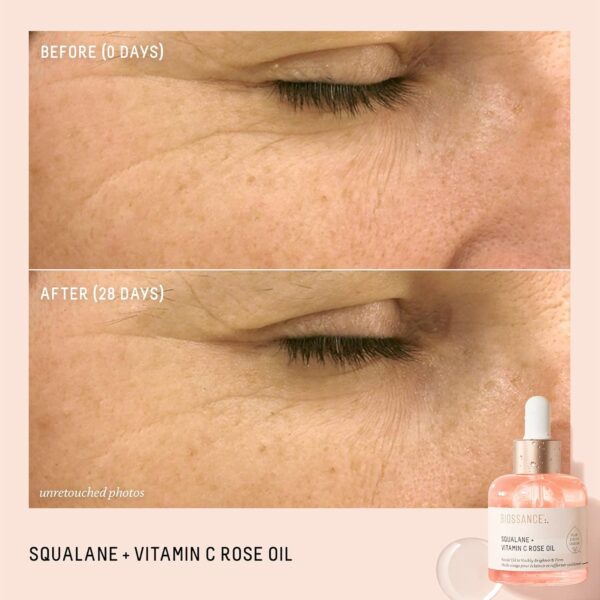 Radiant, Hydrated Skin with BIOSSANCE Vitamin C Rose Oil - Image 2